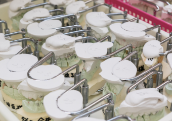 患者様の歯型から作成した歯型の模型です。